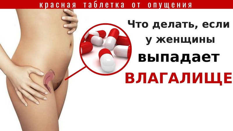 Таблетка от опущения влагалища и