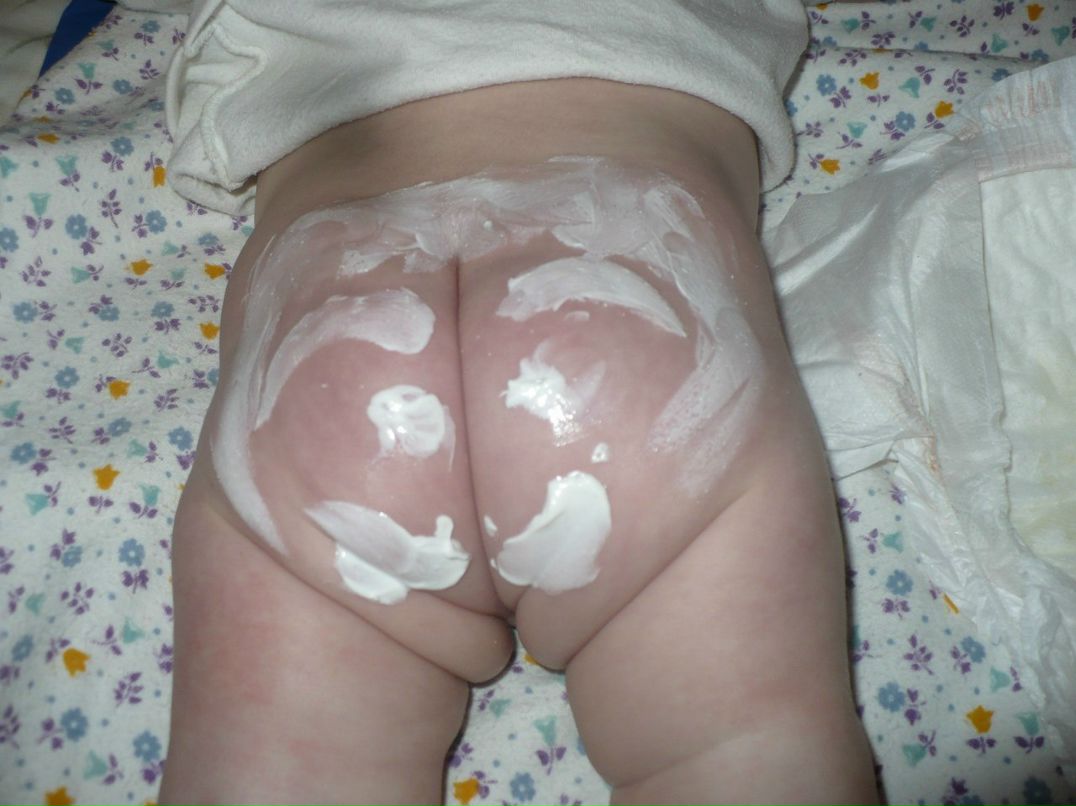 Алёна Трач | Белая Церковь