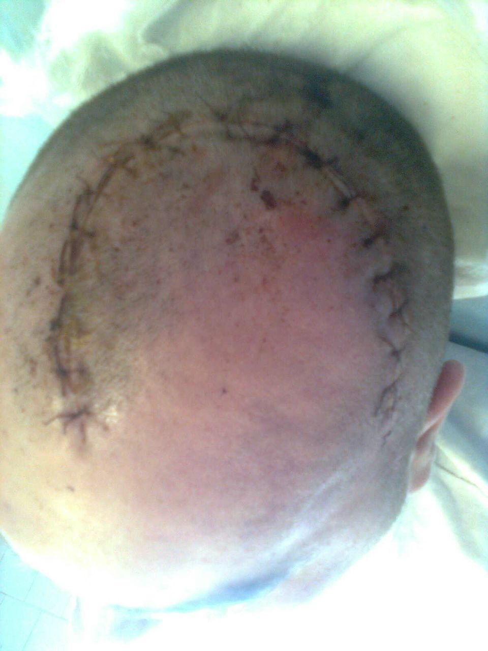 Алексей Штенцов | Пермь