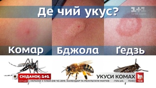 Як розпізнати небезпечний укус комахи і правильно на нього зреагувати - поради дерматолога