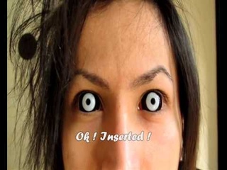 How to: insert and remove sclera negative lenses ( Black sclera with white iris)