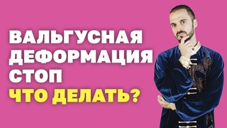 Упражнения при вальгусной деформации стоп! Что делать Гимнастика Цигун! Деформация стоп